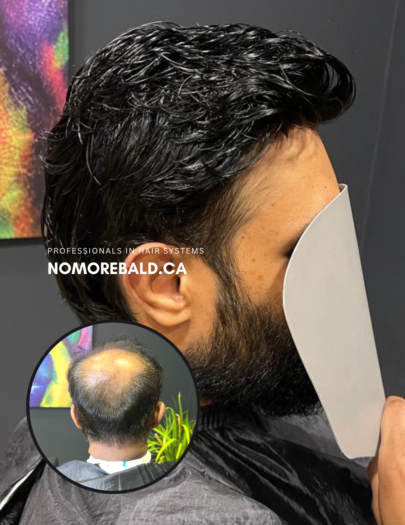 NO MORE BALD – Professionals in Hair Replacements